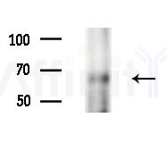 STK33 Antibody - Western blot analysis of extracts from PC12 cells(starvation treatment), using STK33 Antibody at 1/1000 dilution.