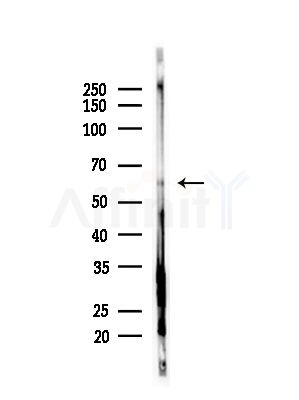 STK33 Antibody - Western blot analysis of lysates from PC12 cells(starvation,24h treatment), using STK33 Antibody at 1/1000 dilution.