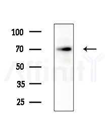 TESK2 Antibody - Western blot analysis of extracts from various samples, using TESK2 Antibody at 1/1000 dilution.