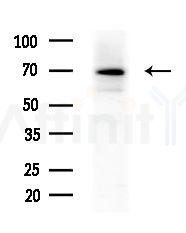 TESK2 Antibody - Western blot analysis of extracts from RAW264.