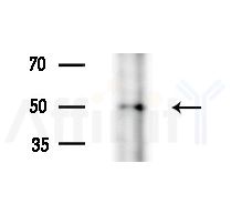 VRK3 Antibody - Western blot analysis of extracts from PC12 cells(starvation treatment), using VRK3 Antibody at 1/1000 dilution.