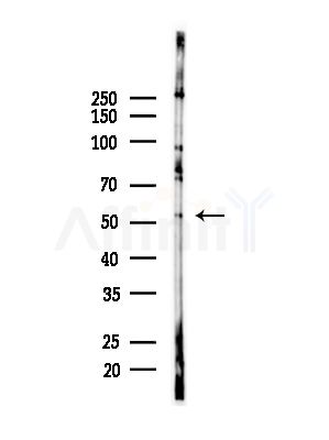VRK3 Antibody - Western blot analysis of lysates from PC12 cells(starvation,24h treatment), using VRK3 Antibody at 1/1000 dilution.