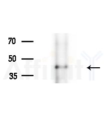 ACTBL2 Antibody - Western blot analysis of extracts from EC304 cells(heat-shock,45min treatment), using ACTBL2 Antibody at 1/1000 dilution.