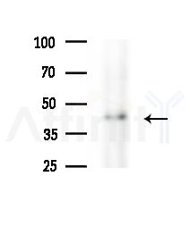 ACTBL2 Antibody - Western blot analysis of extracts from HUVEC cells(starvation,24h treatment), using ACTBL2 Antibody at 1/1000 dilution.