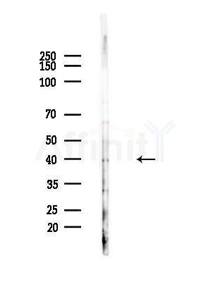 ACTBL2 Antibody - Western blot analysis of lysates from EC304 cells(heat-shock,45min treatment), using ACTBL2 Antibody at 1/1000 dilution.