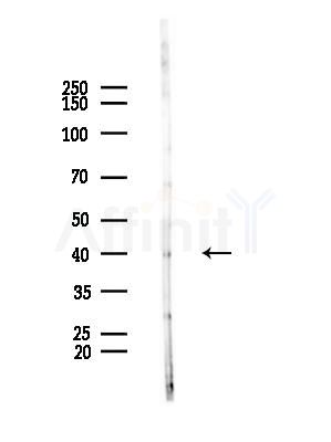ACTBL2 Antibody - Western blot analysis of lysates from HUVEC cells(starvation,24h treatment), using ACTBL2 Antibody at 1/1000 dilution.