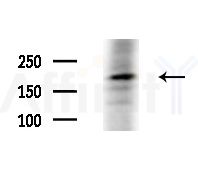 LY75 Antibody - Western blot analysis of extracts from PC12 cells(starvation treatment), using LY75 Antibody at 1/1000 dilution.