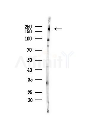 LY75 Antibody - Western blot analysis of lysates from PC12 cells(starvation,24h treatment), using LY75 Antibody at 1/1000 dilution.