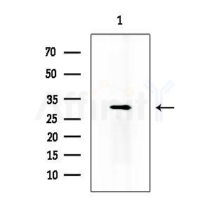 KLRK1 Antibody - Western blot analysis of lysates from Hela cells(heat-shock treatment), using KLRK1 Antibody at 1/1000 dilution.