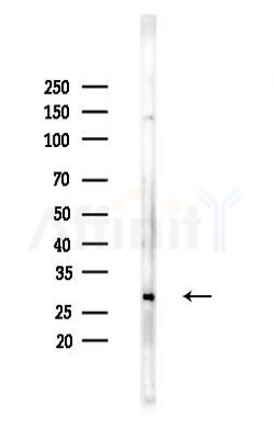 KLRK1 Antibody - Western blot analysis of lysates from Hela cells(heat-shock,45min treatment), using KLRK1 Antibody at 1/1000 dilution.