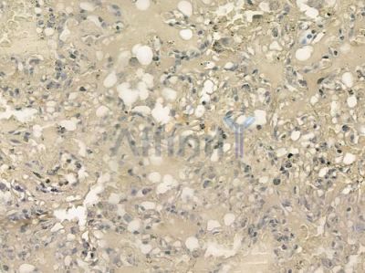 KLRK1 Antibody - DF4816 at 1/100 staining human normal lung tissue by IHC-P.