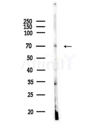 ATG16L2 Antibody - Western blot analysis of lysates from COLO205 cells, using ATG16L2 Antibody at 1/1000 dilution.
