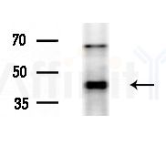 LHX1 Antibody - Western blot analysis of extracts from HepG2 cells(LPS 4h treatment), using LHX1 Antibody at 1/1000 dilution.
