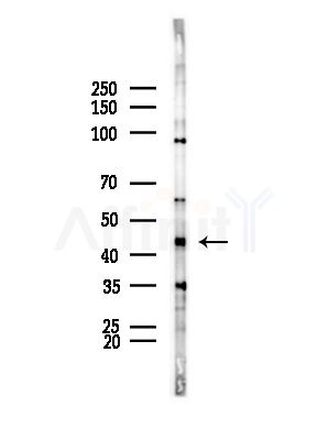 LHX1 Antibody - Western blot analysis of lysates from HepG2 cells(LPS,4h treatment), using LHX1 Antibody at 1/1000 dilution.