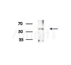 FGB Antibody - Western blot analysis of extracts from Rat liver, using FGB Antibody at 1/1000 dilution.
