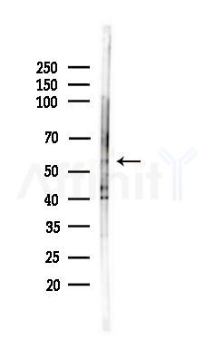 FGB Antibody - Western blot analysis of lysates from Rat liver, using FGB Antibody at 1/1000 dilution.