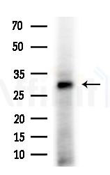 FAM3D Antibody - Western blot analysis of extracts from B16F10-LUC cells(starvation,24h treatment), using FAM3D Antibody at 1/1000 dilution.