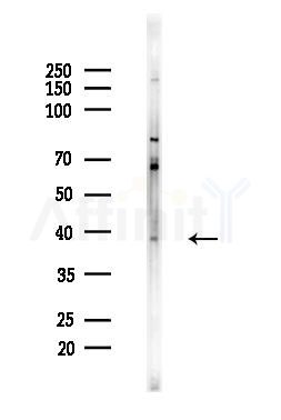 5HT5A receptor Antibody - Western blot analysis of lysates from EC304 cells, using 5HT5A receptor Antibody at 1/1000 dilution.