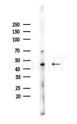 CCRL1 Antibody - Western blot analysis of lysates from Hela cells(heat-shock,45min treatment), using CCRL1 Antibody at 1/1000 dilution.