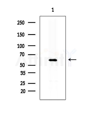 CLPT1 Antibody - Western blot analysis of extracts from Hela cells(heat-shock treatment), using CLPT1 Antibody at 1/1000 dilution.