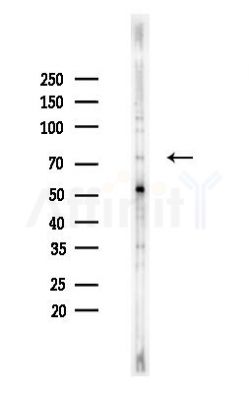 CLPT1 Antibody - Western blot analysis of lysates from Hela cells(heat-shock,45min treatment), using CLPT1 Antibody at 1/1000 dilution.