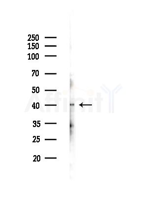EDG2 Antibody - Western blot analysis of lysates from A375 cells(LPS, 4h treatment), using EDG2 Antibody at 1/1000 dilution.