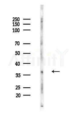 EDG4 Antibody - Western blot analysis of lysates from EC304 cells, using EDG4 Antibody at 1/1000 dilution.