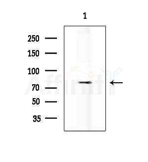 EMR2 Antibody - Western blot analysis of extracts from Rat brain, using EMR2 Antibody at 1/1000 dilution.