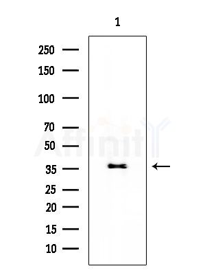 OPN3 Antibody - Western blot analysis of extracts from EC304 cells, using OPN3 Antibody at 1/1000 dilution.