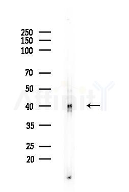 OPN3 Antibody - Western blot analysis of lysates from EC304 cells, using OPN3 Antibody at 1/1000 dilution.