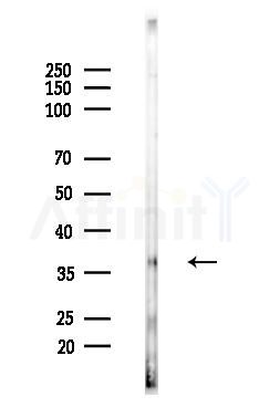 PTGER3 Antibody - Western blot analysis of lysates from EC304 cells, using PTGER3 Antibody at 1/1000 dilution.