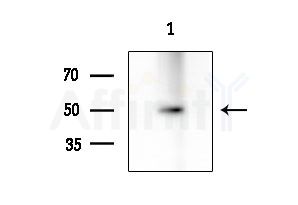 GPR150 Antibody - Western blot analysis of extracts from A549 cells(heat-shock treatment), using GPR150 Antibody at 1/1000 dilution.