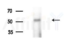 GPR151 Antibody - Western blot analysis of extracts from Rat liver, using GPR151 Antibody at 1/1000 dilution.