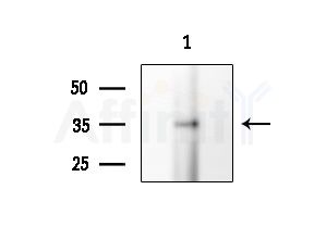 CLTR2 Antibody - Western blot analysis of extracts from A375 cells(heat-shock treatment), using CLTR2 Antibody at 1/1000 dilution.
