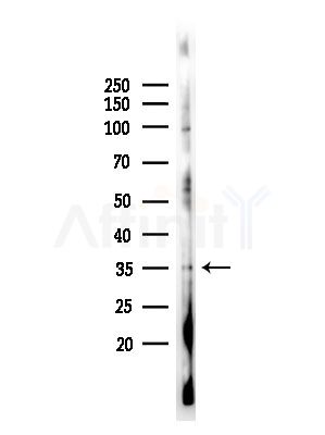 CLTR2 Antibody - Western blot analysis of lysates from A375 cells(heat-shock,45min treatment), using CLTR2 Antibody at 1/1000 dilution.