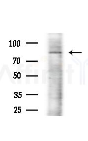 EMR2 Antibody - Western blot analysis of extracts from 293 cells(starvation treatment), using EMR2 Antibody at 1/1000 dilution.