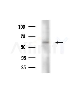 ETBR2 Antibody - Western blot analysis of extracts from Raji cells(heat-shock,45min treatment), using ETBR2 Antibody at 1/1000 dilution.