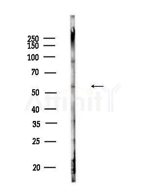 ETBR2 Antibody - Western blot analysis of lysates from Raji cells(heat-shock,45min treatment), using ETBR2 Antibody at 1/1000 dilution.