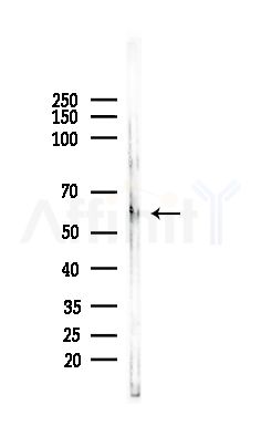 GPR108 Antibody - Western blot analysis of lysates from EC304 cells, using GPR108 Antibody at 1/1000 dilution.