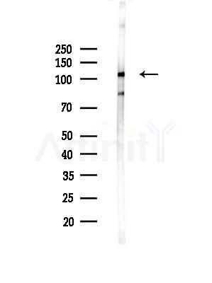 GPR113 Antibody - Western blot analysis of lysates from LoVo cells(heat-shock,45min treatment), using GPR113 Antibody at 1/1000 dilution.