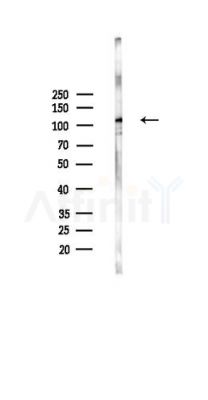 GPR113 Antibody - Western blot analysis of lysates from HUVEC cells(UV,30min treatment), using GPR113 Antibody at 1/1000 dilution.