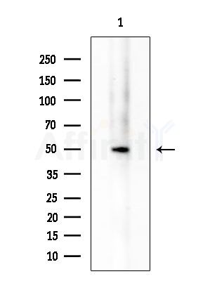 GPR114 Antibody - Western blot analysis of extracts from EC304 cells, using GPR114 Antibody at 1/1000 dilution.