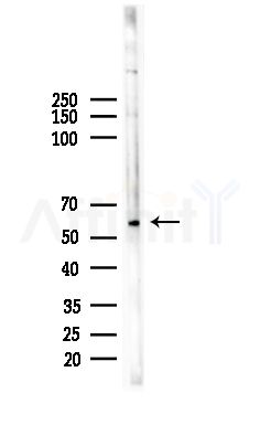 GPR114 Antibody - Western blot analysis of lysates from EC304 cells, using GPR114 Antibody at 1/1000 dilution.