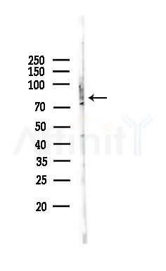GPR115 Antibody - Western blot analysis of lysates from COLO205 cells, using GPR115 Antibody at 1/1000 dilution.