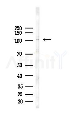 GPR144 Antibody - Western blot analysis of lysates from EC304 cells, using GPR144 Antibody at 1/1000 dilution.