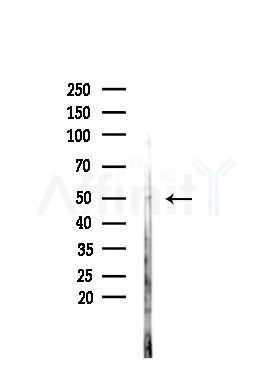 GPR180 Antibody - Western blot analysis of lysates from PC12 cells(heat-shock,45min treatment), using GPR180 Antibody at 1/1000 dilution.