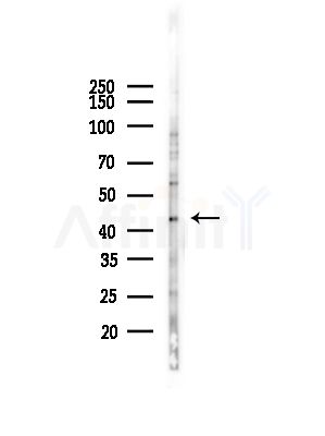 GPR34 Antibody - Western blot analysis of lysates from COLO205 cells(UV,30min treatment), using GPR34 Antibody at 1/1000 dilution.