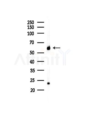 HRH1 Antibody - Western blot analysis of lysates from A375 cells(heat-shock,45min treatment), using HRH1 Antibody at 1/1000 dilution.