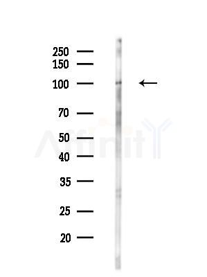 LGR6 Antibody - Western blot analysis of lysates from HUVEC cellsLPS, using LGR6 Antibody at 1/1000 dilution.
