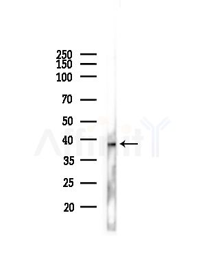 MTR1B Antibody - Western blot analysis of lysates from Hela cells(heat-shock,45min treatment), using MTR1B Antibody at 1/1000 dilution.